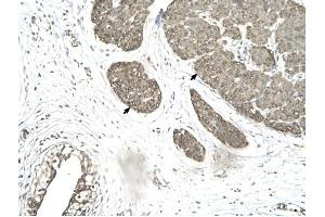 MORF4L1 antibody was used for immunohistochemistry at a concentration of 4-8 ug/ml to stain Smooth muscle cells (arrows) in Human urinary bladder. (MORF4L1 antibody  (Middle Region))