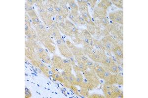 Immunohistochemistry of paraffin-embedded human liver using BECN1 antibody at dilution of 1:100 (40x lens). (Beclin 1 antibody)