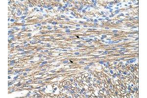 Image no. 1 for anti-Muscleblind-like Protein 1 (MBNL1) (AA 211-260) antibody (ABIN6736245) (MBNL1 antibody  (AA 211-260))