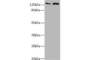 Western blot All lanes: KDM4B antibody at 4 μg/mL Lane 1: Jurkat whole cell lysate Lane 2: k562 whole cell lysate Secondary Goat polyclonal to rabbit IgG at 1/10000 dilution Predicted band size: 122, 51 kDa Observed band size: 122 kDa (KDM4B antibody  (AA 1-260))