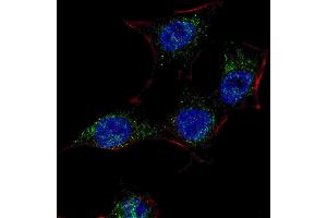 Fluorescent confocal image of HeLa cells stained with SC (Center) antibody. (SREBF chaperone antibody  (AA 604-632))