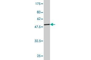 Western Blot detection against Immunogen (53. (TPI1 antibody  (AA 1-249))