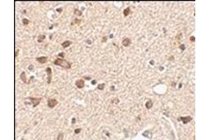 Immunohistochemistry of Stk39 in human brain tissue with this product at 2. (STK39 antibody  (Center))
