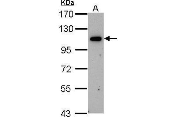 OSBPL6 antibody  (C-Term)