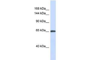 Host:  Rabbit  Target Name:  ZNF280D  Sample Type:  Fetal Brain lysates  Antibody Dilution:  1. (ZNF280D antibody  (N-Term))