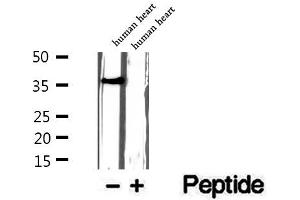 Western blot analysis of extracts of human heart tissue, using ITLN1 antibody. (ITLN1/Omentin antibody  (C-Term))