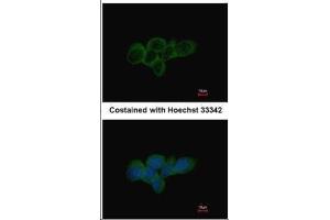 ICC/IF Image Immunofluorescence analysis of methanol-fixed A431, using LDHA, antibody at 1:500 dilution. (Lactate Dehydrogenase A antibody)