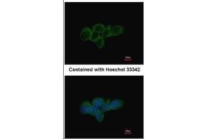 ICC/IF Image Immunofluorescence analysis of methanol-fixed A431, using LDHA, antibody at 1:500 dilution.