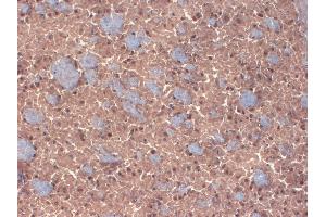 IHC analysis of GABA(A)R Beta 3 in frozen sections of mouse brain extract using GABRB3 antibody. (GABRB3 antibody  (AA 370-433))