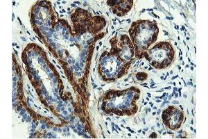 Immunohistochemical staining of paraffin-embedded Human breast tissue using anti-TAGLN mouse monoclonal antibody.