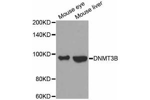 Western blot analysis of extracts of various cell lines, using DNMT3B antibody (ABIN5971501) at 1:300 dilution. (DNMT3B antibody)