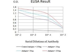 Black line: Control Antigen (100 ng),Purple line: Antigen (10 ng), Blue line: Antigen (50 ng), Red line:Antigen (100 ng) (GLUL antibody  (AA 2-121))