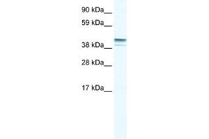 WB Suggested Anti-ZNF627 Antibody Titration:  0. (ZNF627 antibody  (N-Term))