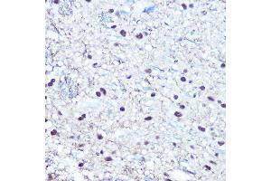 Immunohistochemistry of paraffin-embedded rat brain using Phospho-RB-S780 Rabbit pAb (ABIN3020471, ABIN3020472, ABIN3020473 and ABIN1681996) at dilution of 1:100 (40x lens). (Retinoblastoma 1 antibody  (pSer780))
