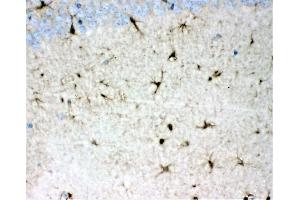 IHC analysis of DDAH1 using anti-DDAH1 antibody (ABIN4886560). (DDAH1 antibody  (C-Term))