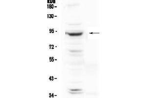 Western blot analysis of PLA2G6 using anti-PLA2G6 antibody .