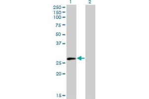 Western Blot analysis of ELF5 expression in transfected 293T cell line by ELF5 monoclonal antibody (M01), clone 3D10. (ELF5 antibody  (AA 166-263))