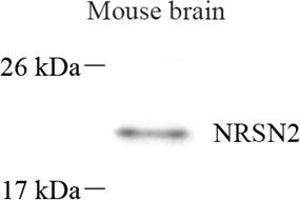 Western blot analysis of NRSN2 (ABIN7074806) at dilution of 1: 500 (NRSN2 antibody)