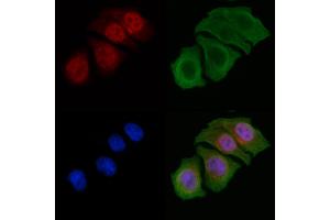 ABIN6256518 and ABIN6267413 staining Hela cells by IF/ICC.