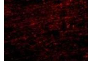 Immunofuorescence of CLIP170 in human brain tissue with AP30238PU-N CLIP170 antibody at 20 μg/ml. (CABS1 antibody  (C-Term))