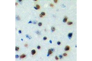 Immunohistochemical analysis of DYRK1B staining in human brain formalin fixed paraffin embedded tissue section. (DYRK1B antibody)