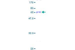 CRYM Protein (AA 1-314) (GST tag)