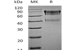 Western Blotting (WB) image for Interleukin 15 Receptor, alpha (IL15RA) (Active) protein (Fc Tag) (ABIN7320556) (IL15RA Protein (Fc Tag))