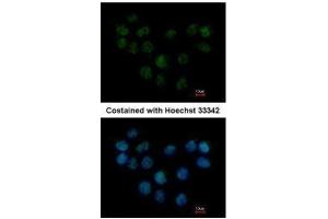 ICC/IF Image Immunofluorescence analysis of paraformaldehyde-fixed A431, using SMC1B, antibody at 1:500 dilution. (SMC1B antibody  (N-Term))