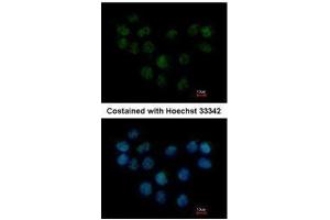 ICC/IF Image Immunofluorescence analysis of paraformaldehyde-fixed A431, using SMC1B, antibody at 1:500 dilution. (SMC1B antibody  (N-Term))