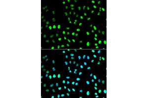 Immunofluorescence analysis of MCF7 cell using SUMO1 antibody. (SUMO1 antibody  (AA 1-101))
