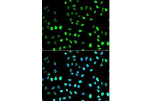 Immunofluorescence analysis of MCF7 cell using SUMO1 antibody.