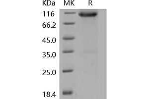 FGFR3 Protein (His tag,Fc Tag)