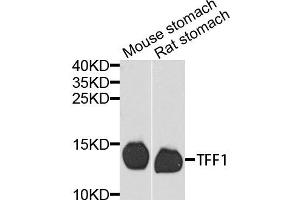 Western blot analysis of extracts of various cells, using TFF1 antibody. (TFF1 antibody)