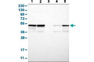 Western Blot analysis with PTPN1 polyclonal antibody . (PTPN1 antibody  (AA 268-406))