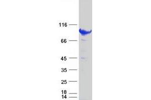 Signal Transducer and Activator of Transcription 5B (STAT5B) protein (Myc-DYKDDDDK Tag)