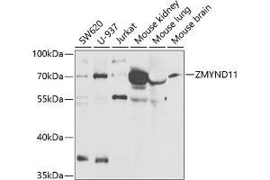Western blot analysis of extracts of various cell lines, using ZMYND11 antibody (ABIN6133152, ABIN6150457, ABIN6150458 and ABIN6221937) at 1:1000 dilution. (ZMYND11 antibody  (AA 278-567))