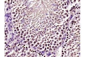 Paraformaldehyde-fixed, paraffin embedded mouse testis, Antigen retrieval by boiling in sodium citrate buffer (pH6) for 15min, Block endogenous peroxidase by 3% hydrogen peroxide for 30 minutes,  Blocking buffer (normal goat serum) at 37°C for 20min, Antibody incubation with CREM Polyclonal Antibody at 1:400 overnight at 4°C, followed by a conjugated secondary and DAB staining. (CREM antibody  (AA 251-361))