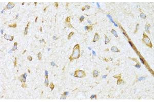 Immunohistochemistry of paraffin-embedded Mouse spinal cord using DNAJB11 Polyclonal Antibody at dilution of 1:100 (40x lens).