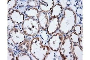 Immunohistochemical staining of paraffin-embedded Kidney tissue using anti-LIPG mouse monoclonal antibody. (LIPG antibody)