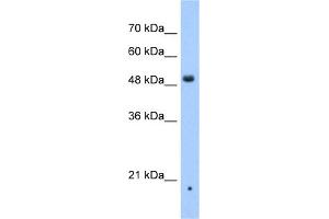 WB Suggested Anti-ZDHHC16 Antibody Titration:  0. (ZDHHC16 antibody  (N-Term))