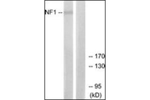 Western blot analysis of extracts from HepG2 cells, using NF1 Antibody. (Neurofibromin 1 antibody  (Internal Region))