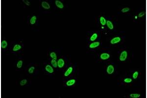 HIST1H2BB antibody  (acLys5)