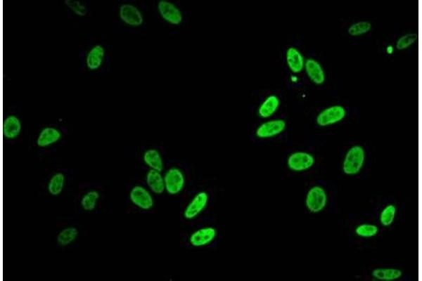 HIST1H2BB antibody  (acLys5)