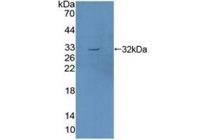 Detection of Recombinant SGK1, Mouse using Polyclonal Antibody to Serum/Glucocorticoid Regulated Kinase 1 (SGK1) (SGK1 antibody  (AA 145-386))