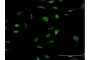 Immunofluorescence of purified MaxPab antibody to ZFP42 on HeLa cell. (ZFP42 antibody  (AA 1-310))