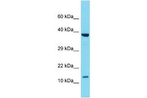Western Blotting (WB) image for anti-Secretoglobin, Family 2A, Member 1 (SCGB2A1) (N-Term) antibody (ABIN2788420) (SCGB2A1 antibody  (N-Term))