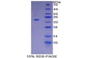 SDS-PAGE (SDS) image for Dynamin 1 (DNM1) (AA 572-745) protein (His tag) (ABIN2124671)