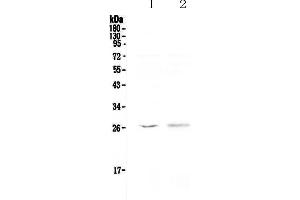 Western blot analysis of Kallikrein 6 using anti-Kallikrein 6 antibody . (Kallikrein 6 antibody  (AA 22-244))