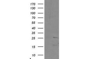 Image no. 1 for anti-PYD and CARD Domain Containing (PYCARD) antibody (ABIN1500519) (PYCARD antibody)