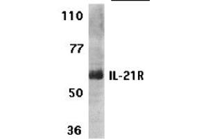 Western Blotting (WB) image for anti-Interleukin 21 Receptor (IL21R) (N-Term) antibody (ABIN1031410) (IL21 Receptor antibody  (N-Term))